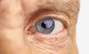 retinal-problems